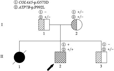 Clinical features and familial mutations in the coexistence of Wilson's disease and Alport syndrome: A case report